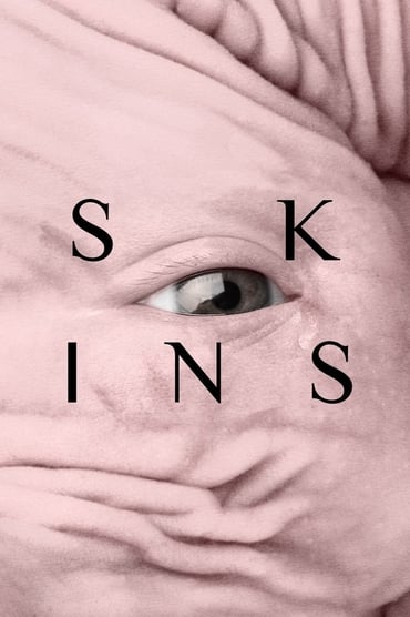 Pieles Aka Skins (2017) online sa prevodom
