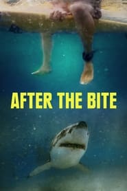 After the Bite (2023) online sa prevodom
